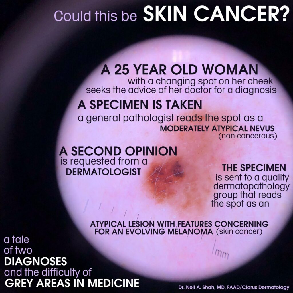 A tale of two diagnoses illustrating skin cancer screening challenges