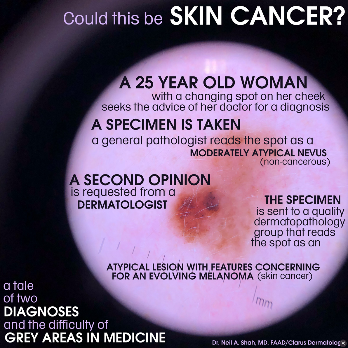 Skin cancer diagnosis comparison showing two different lesions