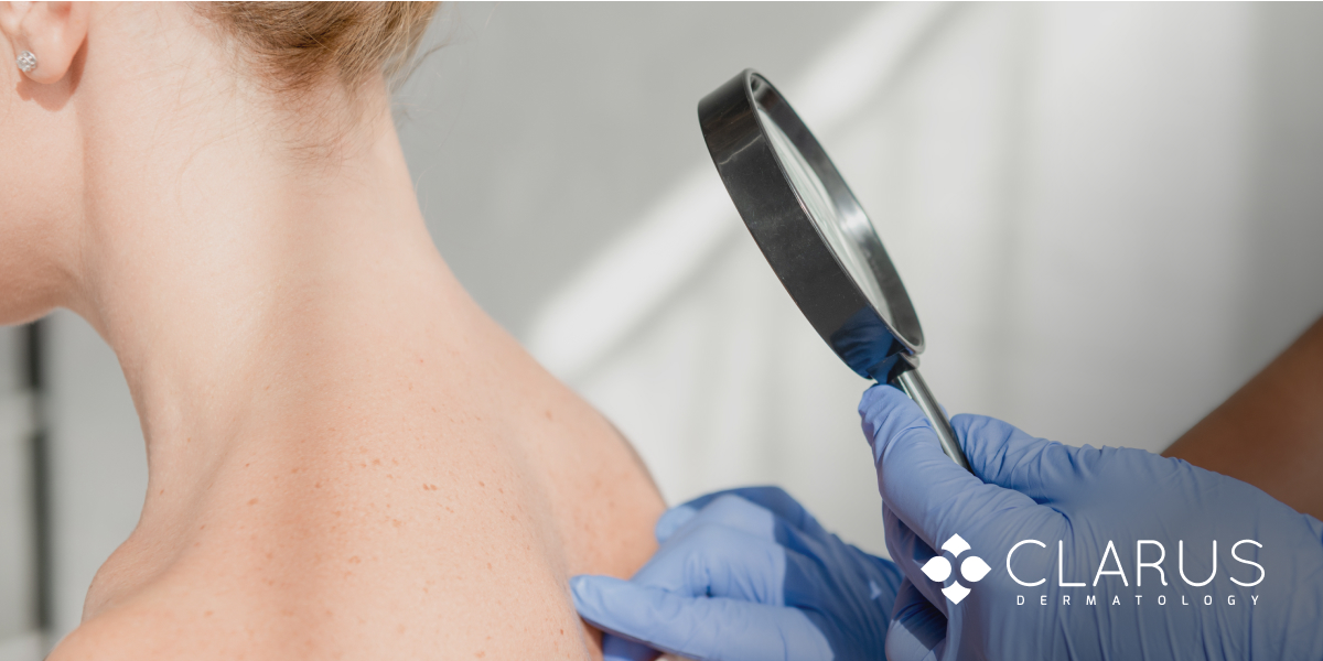 Clarus Dermatology homepage featured image