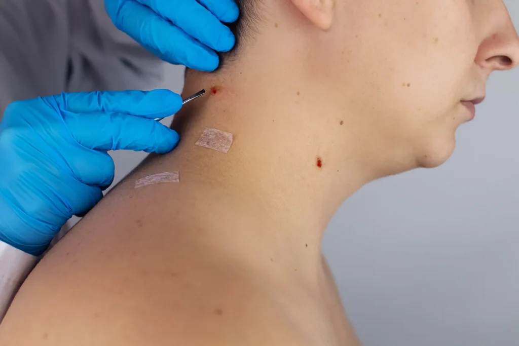 Self-pay dermatology visit saving stress and time