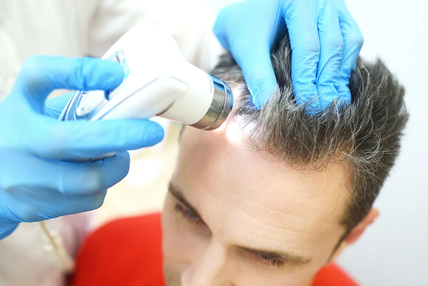 Hair loss and alopecia types explained by dermatologist
