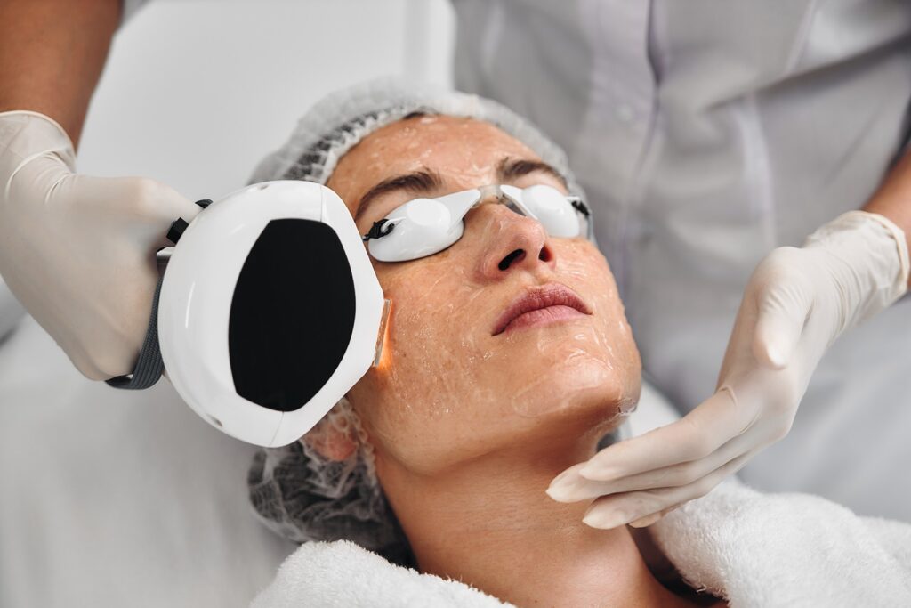 Rosacea treatment options for calming skin redness