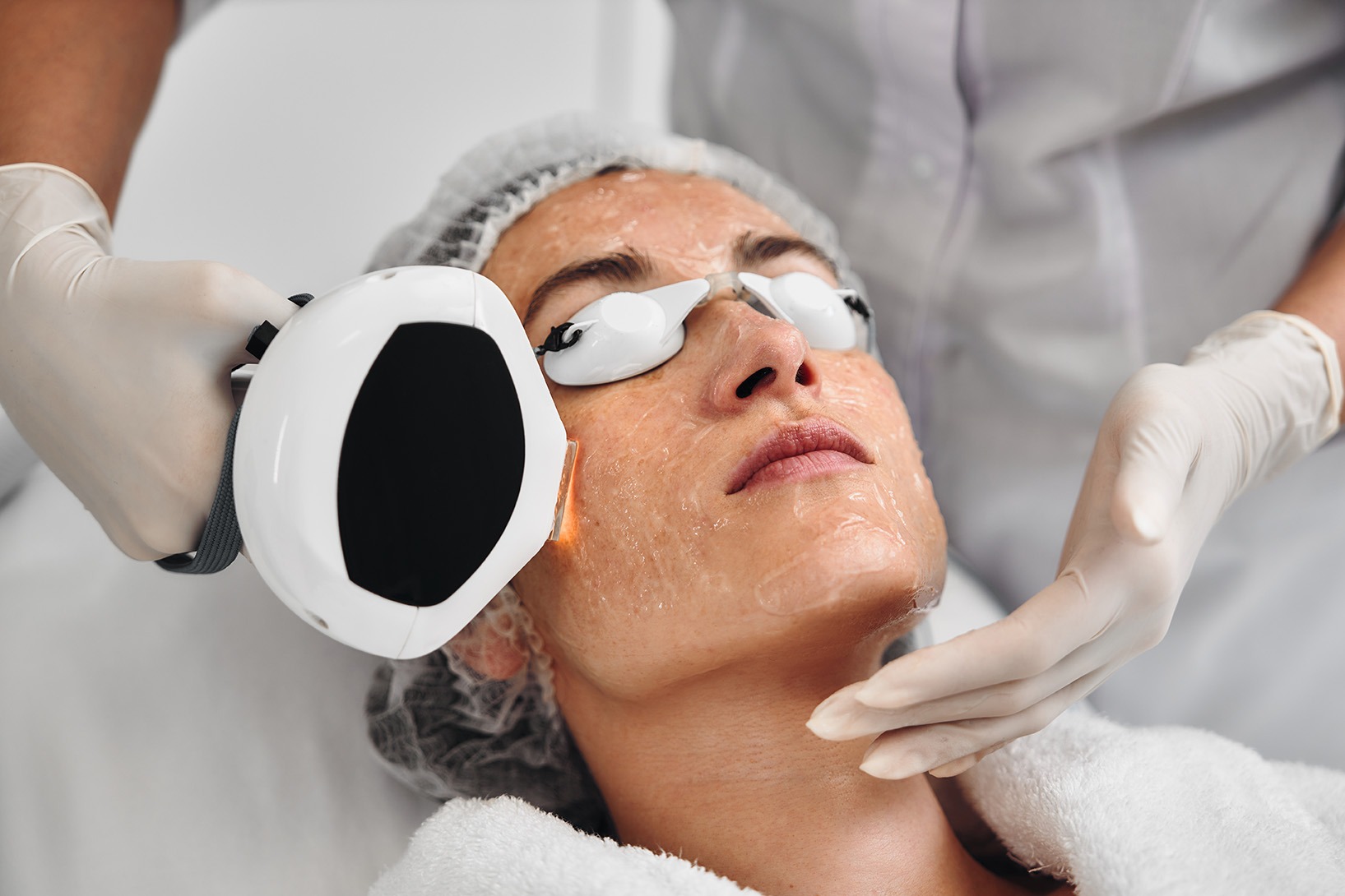 Rosacea treatment options for calming skin redness