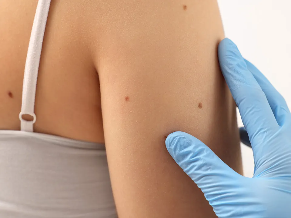 Dermatologist skin exam for winter skincare in Minneapolis