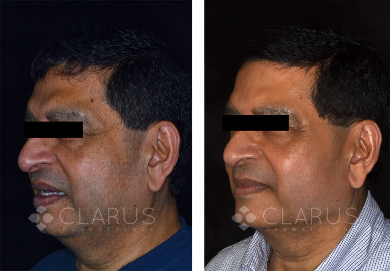 Multi-Treatments for Aging and Sun Damage 2