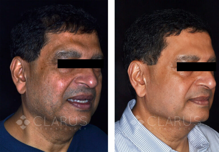 Multi-Treatments for Aging and Sun Damage 2