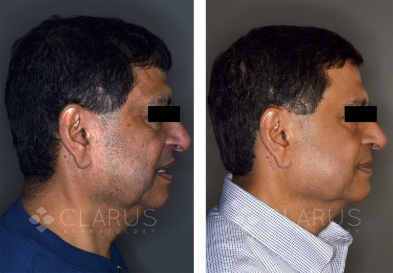 Multi-Treatments for Aging and Sun Damage 2