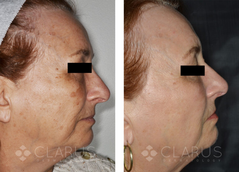 Multi-Treatments for Aging and Sun Damage