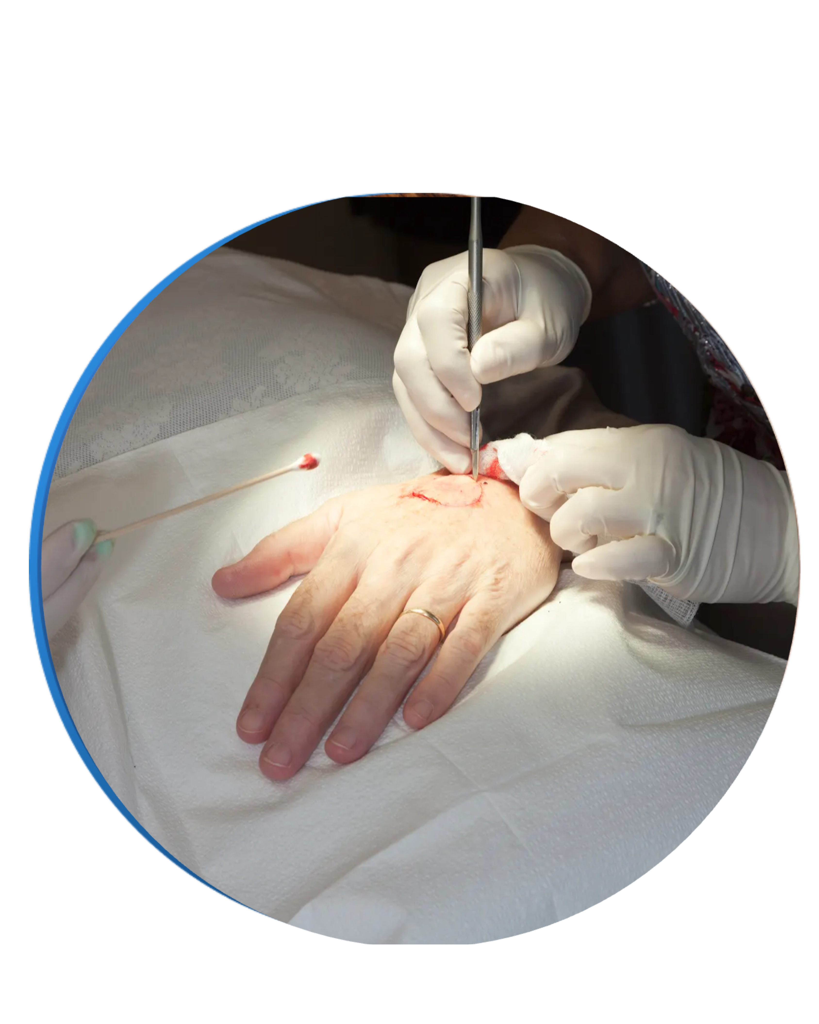Surgical Dermatology