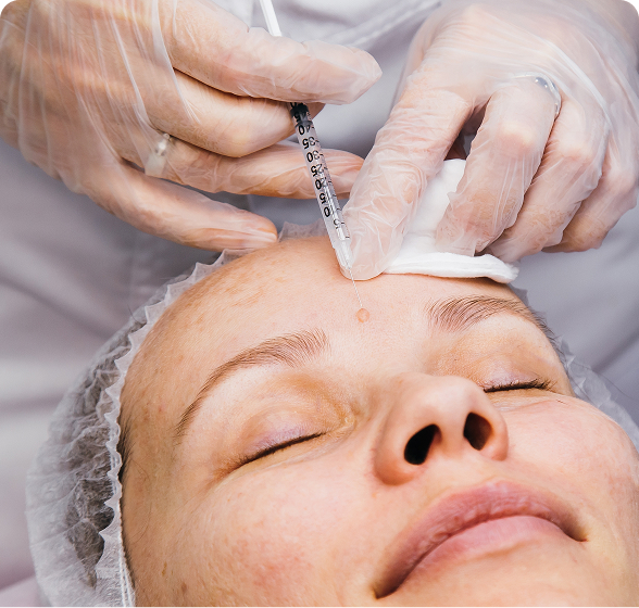 Medical-Dermatology Image