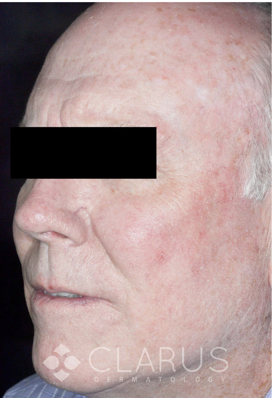 After Image